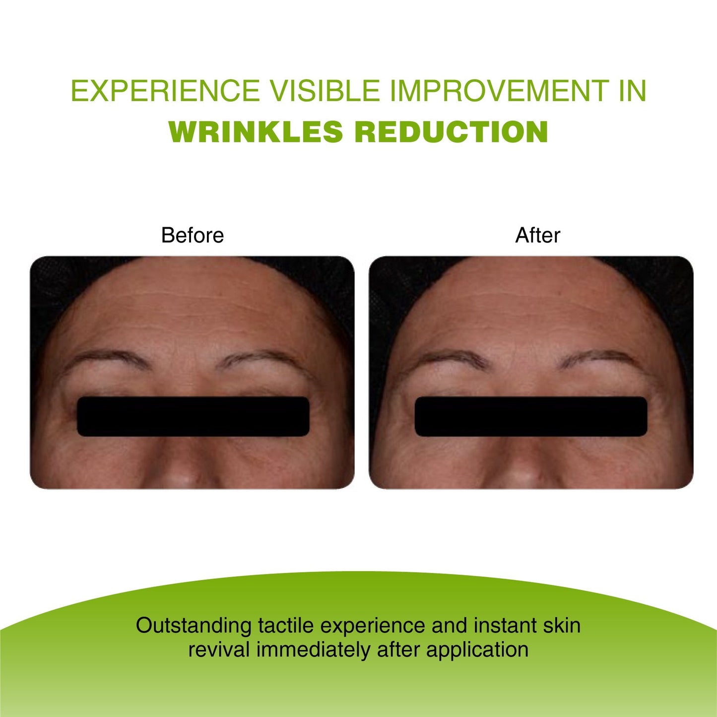 Sérum Visage Vitamine C Vijuve à l’Acide Hyaluronique Double Effet – 45 % de Vitamine C